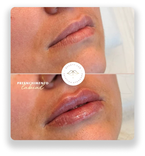 7thbeautylab-antes-e-depois-bruno-conzi-1