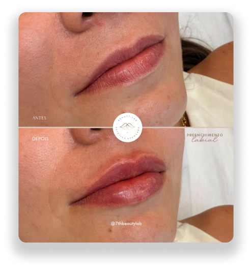 7thbeautylab-antes-e-depois-bruno-conzi-2