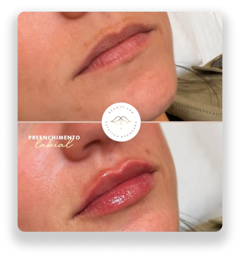 7thbeautylab-antes-e-depois-bruno-conzi-3